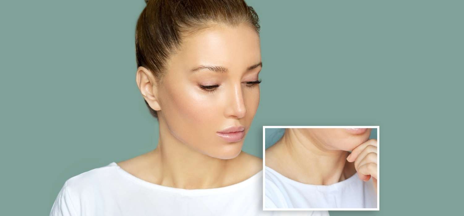 Neck Lift