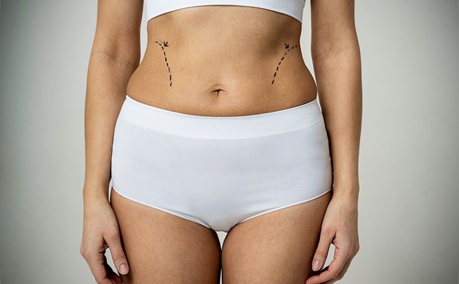 post-bariatric-surgery-media-content-1